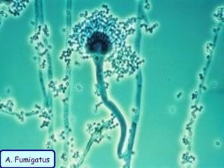 A. Fumigatus
 