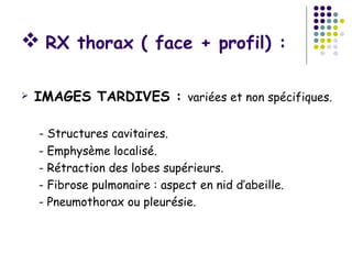  RX thorax ( face + profil) :

   IMAGES TARDIVES : variées et non spécifiques.

    - Structures cavitaires.
    - Emphysème localisé.
    - Rétraction des lobes supérieurs.
    - Fibrose pulmonaire : aspect en nid d’abeille.
    - Pneumothorax ou pleurésie.
 