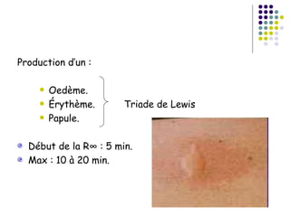 Production d’un :

        Oedème.
        Érythème.     Triade de Lewis
        Papule.

  Début de la R° : 5 min.
  Max : 10 à 20 min.
 