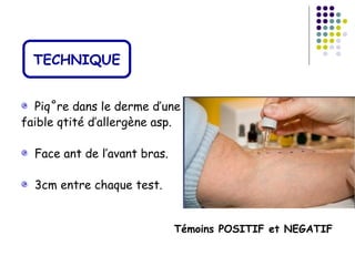 TECHNIQUE


  Piqûre dans le derme d’une
faible qtité d’allergène asp.

  Face ant de l’avant bras.

  3cm entre chaque test.


                              Témoins POSITIF et NEGATIF
 