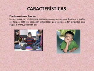 Problemas de coordinación
Las personas con el síndrome presentan problemas de coordinación y suelen
ser torpes, esto les ocasionan dificultades para correr, saltar, dificultad para
seguir el ritmo, pedalear, etc.
CARACTERÍSTICAS
 