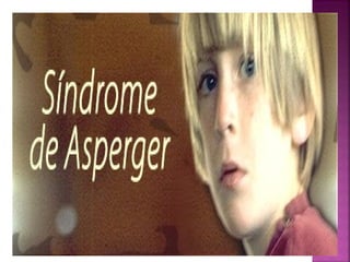  
El Síndrome de Asperger
 
