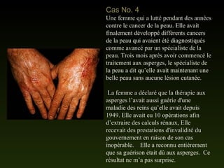 Cas No. 4
Une femme qui a lutté pendant des années
contre le cancer de la peau. Elle avait
finalement développé différents cancers
de la peau qui avaient été diagnostiqués
comme avancé par un spécialiste de la
peau. Trois mois après avoir commencé le
traitement aux asperges, le spécialiste de
la peau a dit qu’elle avait maintenant une
belle peau sans aucune lésion cutanée.
La femme a déclaré que la thérapie aux
asperges l’avait aussi guérie d'une
maladie des reins qu’elle avait depuis
1949. Elle avait eu 10 opérations afin
d’extraire des calculs rénaux, Elle
recevait des prestations d'invalidité du
gouvernement en raison de son cas
inopérable. Elle a reconnu entièrement
que sa guérison était dû aux asperges. Ce
résultat ne m’a pas surprise.
 