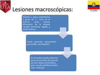 Lesiones macroscópicas:
Nódulos o placa amarillentas
o grises de 1 – 7mm en el
pulmón
sacos
aéreos,
bifurcación de la tráquea
cavidad peritoneal hígado y
pared torácica

Puede presentar aerosaculitis,
pericarditis, perihepatitis

En el cerebro puede presentar
áreas circunscritas de necrosis
de color blanco amarillento,
pero cuando proliferan tienen
color verde gris

Ecuador

 