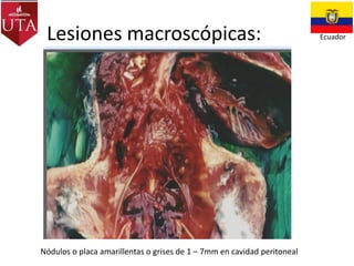 Lesiones macroscópicas:

Nódulos o placa amarillentas o grises de 1 – 7mm en cavidad peritoneal

Ecuador

 