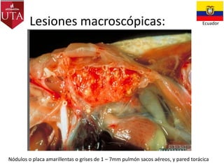 Lesiones macroscópicas:

Ecuador

Nódulos o placa amarillentas o grises de 1 – 7mm pulmón sacos aéreos, y pared torácica

 