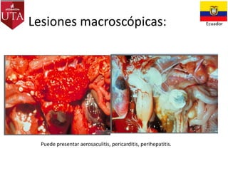 Lesiones macroscópicas:

Puede presentar aerosaculitis, pericarditis, perihepatitis.

Ecuador

 