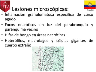 Lesiones microscópicas:

Ecuador

• Inflamación granulomatosa especifica de curso
agudo
• Focos necróticos en luz del parabronquio y
parénquima vecino
• Hifas de hongo en áreas necróticas
• Heterófilos, macrófagos y células gigantes de
cuerpo extraño

 