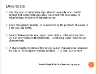 DIAGNOSIS 
 The diagnosis of pulmonary aspergilloma is usually based on the 
clinical and radiographic features, combined with serological or 
microbiologic evidence of Aspergillus spp. 
 Chest radiography is useful in demonstrating the presence of a mass in 
a pre-existing cavity. 
 Aspergilloma appears as an upper-lobe, mobile, intra-cavitary mass 
with an air crescent in the periphery. Localized pleural thickening is 
characteristic 
 A change in the position of the fungus ball after moving the patient on 
his side or from supine to prone position ( Tilt test ) can be seen 
Semin Respir Crit Care Med 2004;25:203-19. 
 