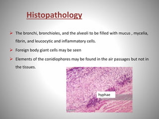 Histopathology
 The bronchi, bronchioles, and the alveoli to be filled with mucus , mycelia,
fibrin, and leucocytic and inflammatory cells.
 Foreign body giant cells may be seen
 Elements of the conidiophores may be found in the air passages but not in
the tissues.
hyphae
 
