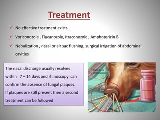 Treatment
 No effective treatment exists .
 Voriconozole , Flucanozole, Itraconozole , Amphotericin B
 Nebulization , nasal or air sac flushing, surgical irrigation of abdominal
cavities
The nasal discharge usually resolves
within 7 – 14 days and rhinoscopy can
confirm the absence of fungal plaques.
If plaques are still present then a second
treatment can be followed
 