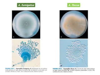 A. fumigatus A. flavus
 