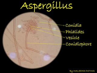 Aspergillus
Conidia
Phialides
Vesicle
Conidiophore
By MALEEHA FATIMA
 