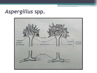 Aspergillus spp.
 