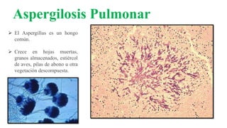 Aspergilosis Pulmonar
 El Aspergillus es un hongo
común.
 Crece en hojas muertas,
granos almacenados, estiércol
de aves, pilas de abono u otra
vegetación descompuesta.
 