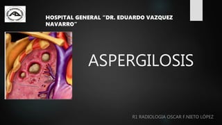 ASPERGILOSIS
R1 RADIOLOGIA OSCAR F.NIETO LÓPEZ
HOSPITAL GENERAL “DR. EDUARDO VAZQUEZ
NAVARRO”
 