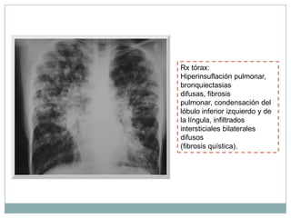 Rx tórax:
Hiperinsuflación pulmonar,
bronquiectasias
difusas, fibrosis
pulmonar, condensación del
lóbulo inferior izquierdo y de
la língula, infiltrados
intersticiales bilaterales
difusos
(fibrosis quística).
 