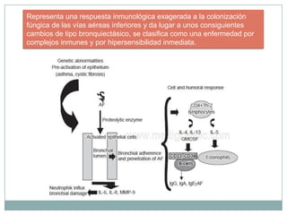 Representa una respuesta inmunológica exagerada a la colonización
fúngica de las vías aéreas inferiores y da lugar a unos consiguientes
cambios de tipo bronquiectásico, se clasifica como una enfermedad por
complejos inmunes y por hipersensibilidad inmediata.
 