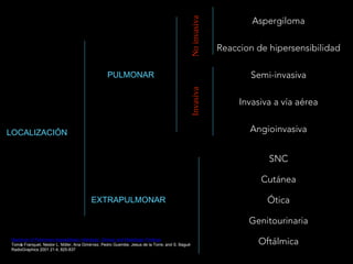 LOCALIZACIÓN
PULMONAR
EXTRAPULMONAR
Aspergiloma
Reaccion de hipersensibilidad
Semi-invasiva
Invasiva a vía aérea
Angioinvasiva
NoinvasivaInvasiva
SNC
Cutánea
Ótica
Genitourinaria
OftálmicaSpectrum of Pulmonary Aspergillosis: Histologic, Clinical, and Radiologic Findings
Tomás Franquet, Nestor L. Müller, Ana Giménez, Pedro Guembe, Jesus de la Torre, and S. Bagué
RadioGraphics 2001 21:4, 825-837
 