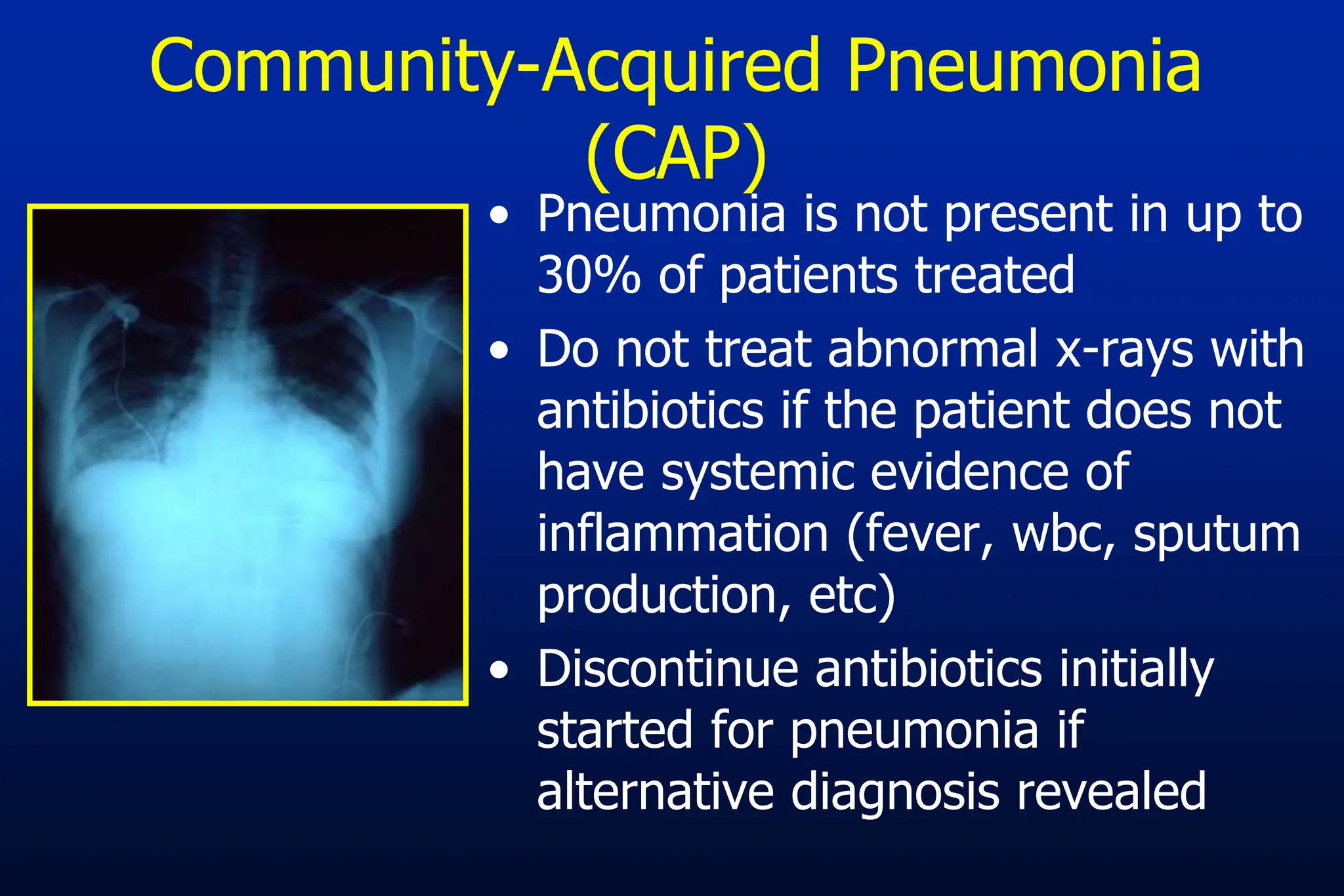 • Pneumonia is not present in up to
30% of patients treated
• Do not treat abnormal x-rays with
antibiotics if the patient does not
have systemic evidence of
inflammation (fever, wbc, sputum
production, etc)
• Discontinue antibiotics initially
started for pneumonia if
alternative diagnosis revealed
Community-Acquired Pneumonia
(CAP)
 