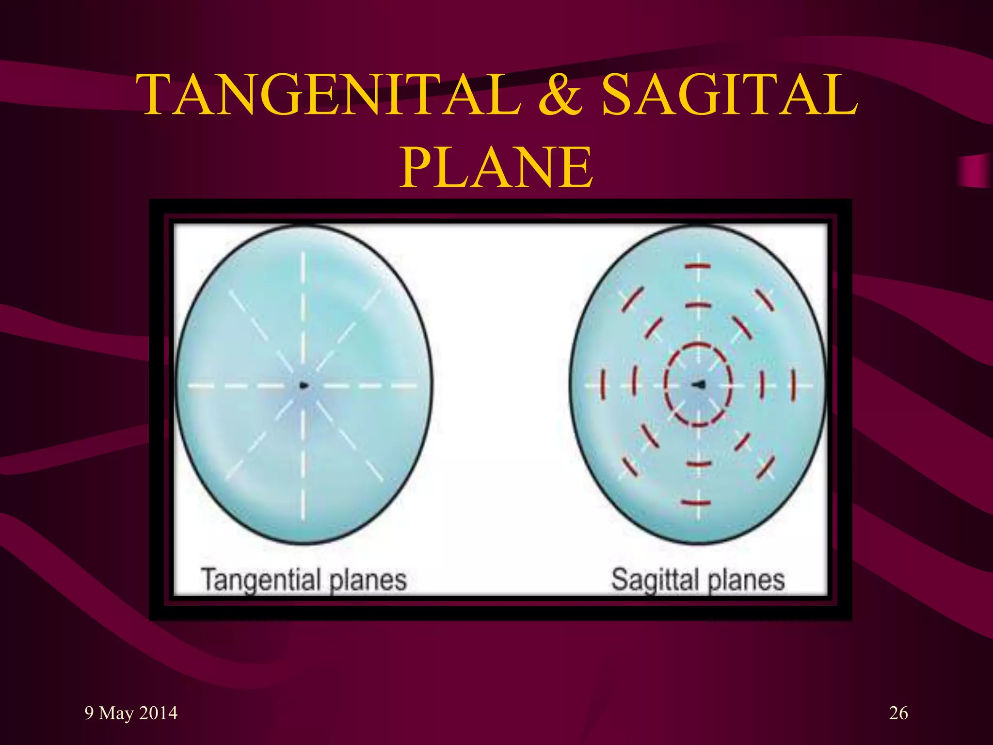 TANGENITAL & SAGITAL
PLANE
9 May 2014 26
 