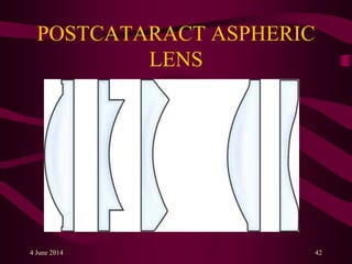 POSTCATARACT ASPHERIC
LENS
4 June 2014 42
 