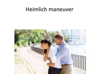 Heimlich maneuver
 