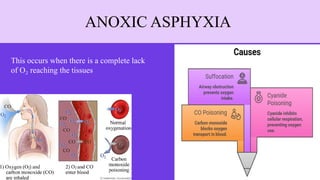 Asphyxia.pptx Asphyxial death with its classification and causes | PPTX
