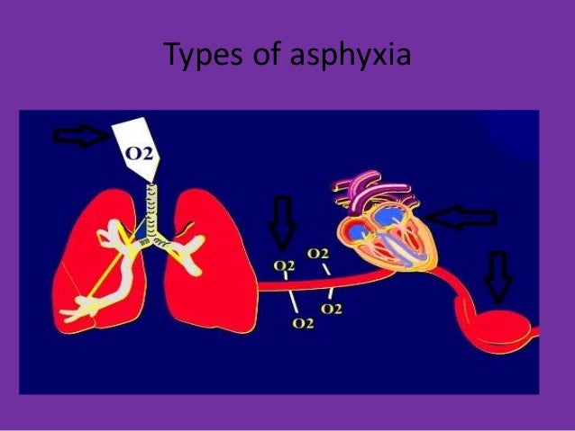 Asphyxia