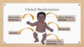 Clinical Manifestations
Poor/weak/
absent cry
Apnea, Dyspnea,
grunting
Hypotonia, limp
extremities
Cyanosis
Bradycardia
 