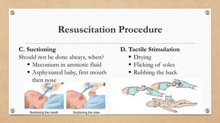 Resuscitation Procedure
C. Suctioning
Should not be done always, when?
 Meconium in amniotic fluid
 Asphyxiated baby, first mouth
then nose
D. Tactile Stimulation
 Drying
 Flicking of soles
 Rubbing the back
 
