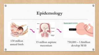 Epidemology
130 million
annual birth
15 million aspirate
meconium
750,000 – 1.8million
develop MAS
 