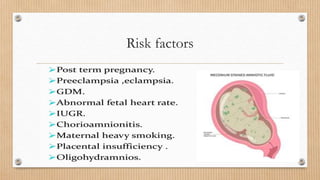 Risk factors
 