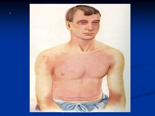 .
.




    Dr Hemanth S Naik, BMCRI
 