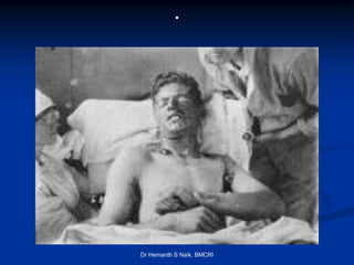 .




Dr Hemanth S Naik, BMCRI
 