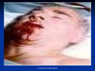 Dr Hemanth S Naik, BMCRI
 