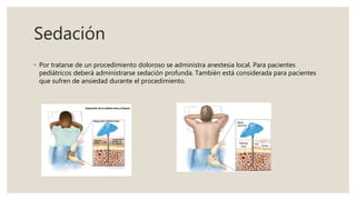 Sedación
◦ Por tratarse de un procedimiento doloroso se administra anestesia local. Para pacientes
pediátricos deberá administrarse sedación profunda. También está considerada para pacientes
que sufren de ansiedad durante el procedimiento.
 