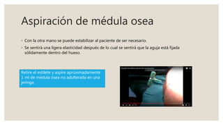 Aspiración de médula osea
◦ Con la otra mano se puede estabilizar al paciente de ser necesario.
◦ Se sentirá una ligera elasticidad después de lo cual se sentirá que la aguja está fijada
sólidamente dentro del hueso.
Retire el estilete y aspire aproximadamente
1 ml de médula ósea no adulterada en una
jeringa.
 