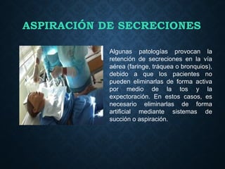 procedimientos :ASPIRACION DE SECRECIONES .pptx