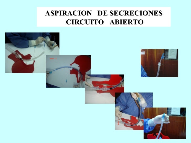 Aspiracion Secreciones