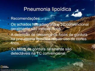 Pneumonia lipoídica

    Recomendações

    Os achados na radiografia e TC convencional
    geralmente são inespecíficos.

    A detecção de presença de focos de gordura
    na pneumonia lipoídica requer uso de cortes
    finos.

    Os focos de gordura raramente são
    detectáveis na TC convencional.
 