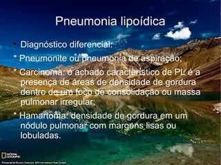 Pneumonia lipoídica

    Diagnóstico diferencial:
* Pneumonite ou pneumonia de aspiração;
* Carcinoma: o achado característico de PL é a
  presença de áreas de densidade de gordura
  dentro de um foco de consolidação ou massa
  pulmonar irregular;
* Hamartoma: densidade de gordura em um
  nódulo pulmonar com margens lisas ou
  lobuladas.
 