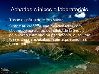 Achados clínicos e laboratoriais

    Tosse e asfixia de início súbito;

    Sintomas crônicos são relacionados com
    obstrução parcial ou completa do brônquio
    pelo corpo estranho ou pneumonia, e incluem
    tosse, dispneia, sibilos, febre e pneumonias
    recorrentes;
 