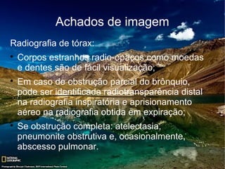 Achados de imagem
Radiografia de tórax:

    Corpos estranhos radio-opacos como moedas
    e dentes são de fácil visualização;

    Em caso de obstrução parcial do brônquio,
    pode ser identificada radiotransparência distal
    na radiografia inspiratória e aprisionamento
    aéreo na radiografia obtida em expiração;

    Se obstrução completa: atelectasia,
    pneumonite obstrutiva e, ocasionalmente,
    abscesso pulmonar.
 