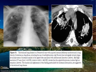 Aspiração 12.07.12 final