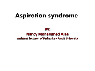 Aspiration syndrome
 
