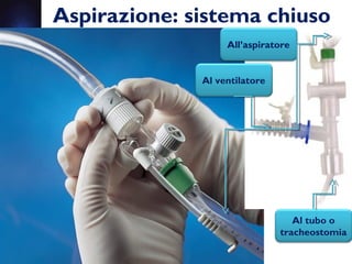 Aspirazione: sistema chiuso
Al tubo o
tracheostomia
Al ventilatore
All’aspiratore
 