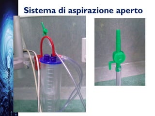 Sistema di aspirazione aperto
 