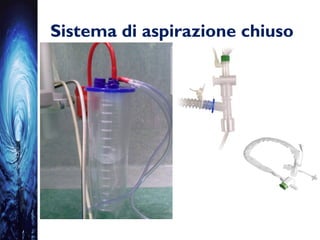 Sistema di aspirazione chiuso
 