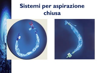 Sistemi per aspirazione
chiusa
 
